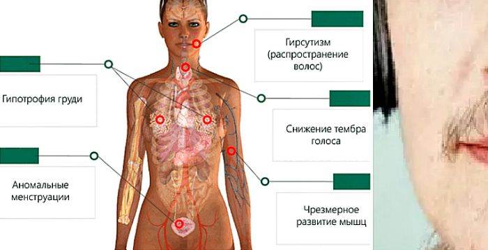 Тестостерон у женщин. При повышенном тестостероне у женщин. Повышен тестостерон у женщин. Повышен тестостерон у женщин симптомы.