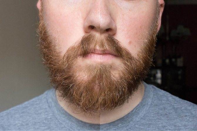 Что сделать, чтобы борода росла быстрее и гуще