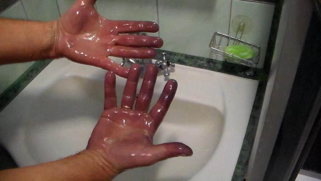 Как и чем отмыть марганцовку с рук и кожи под ногтями?