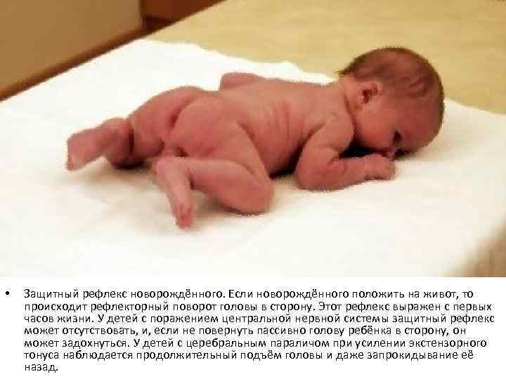 Выкладывание новорожденного на живот: когда и как праивльно