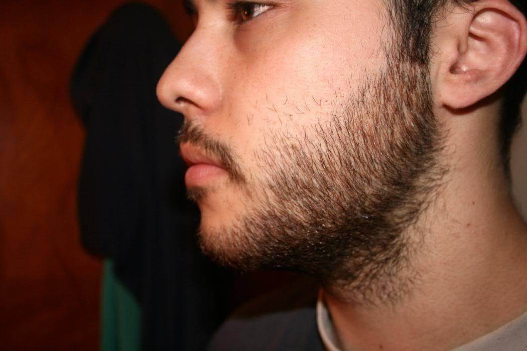 Почему в 30 лет борода не растет, причины отсутствия роста