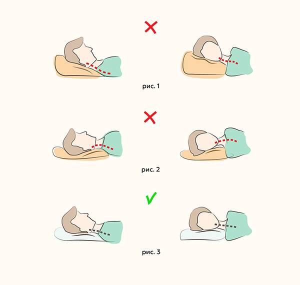 Особенности выбора и использования ортопедической подушки