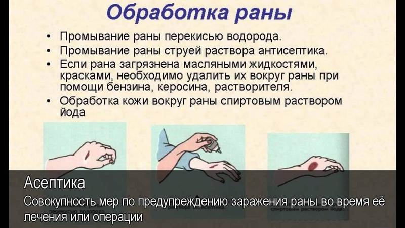 Как ускорить заживление раны?