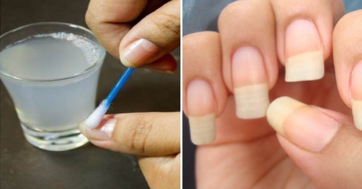 Как в домашних условиях отрастить ногти за 2 дня — лучшие методы