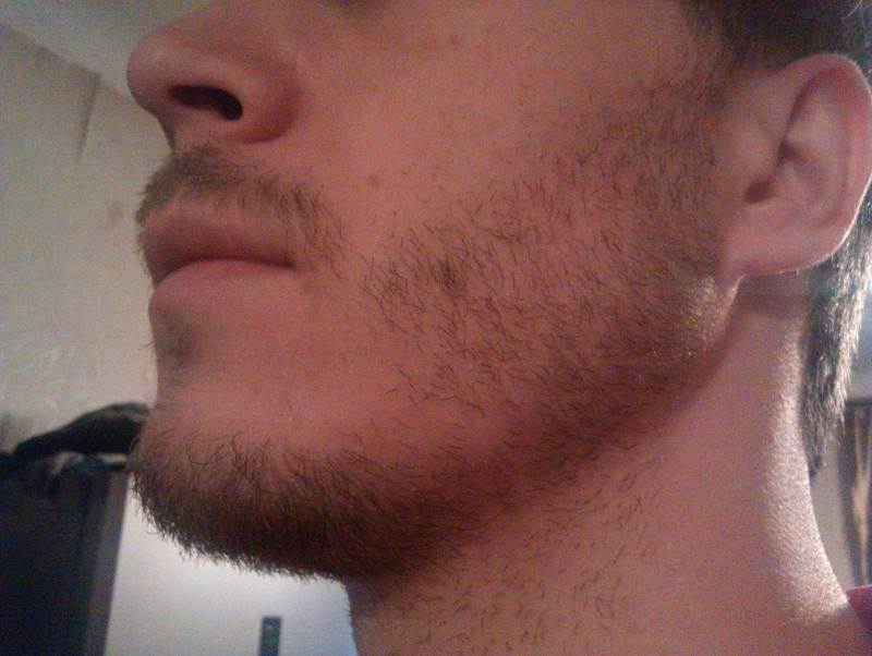 Что делать если не растет борода: причины отсутствия щетины и способы их устранения