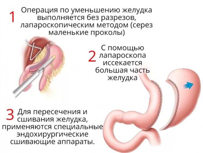 Симптомы и лечение дисфункции печени