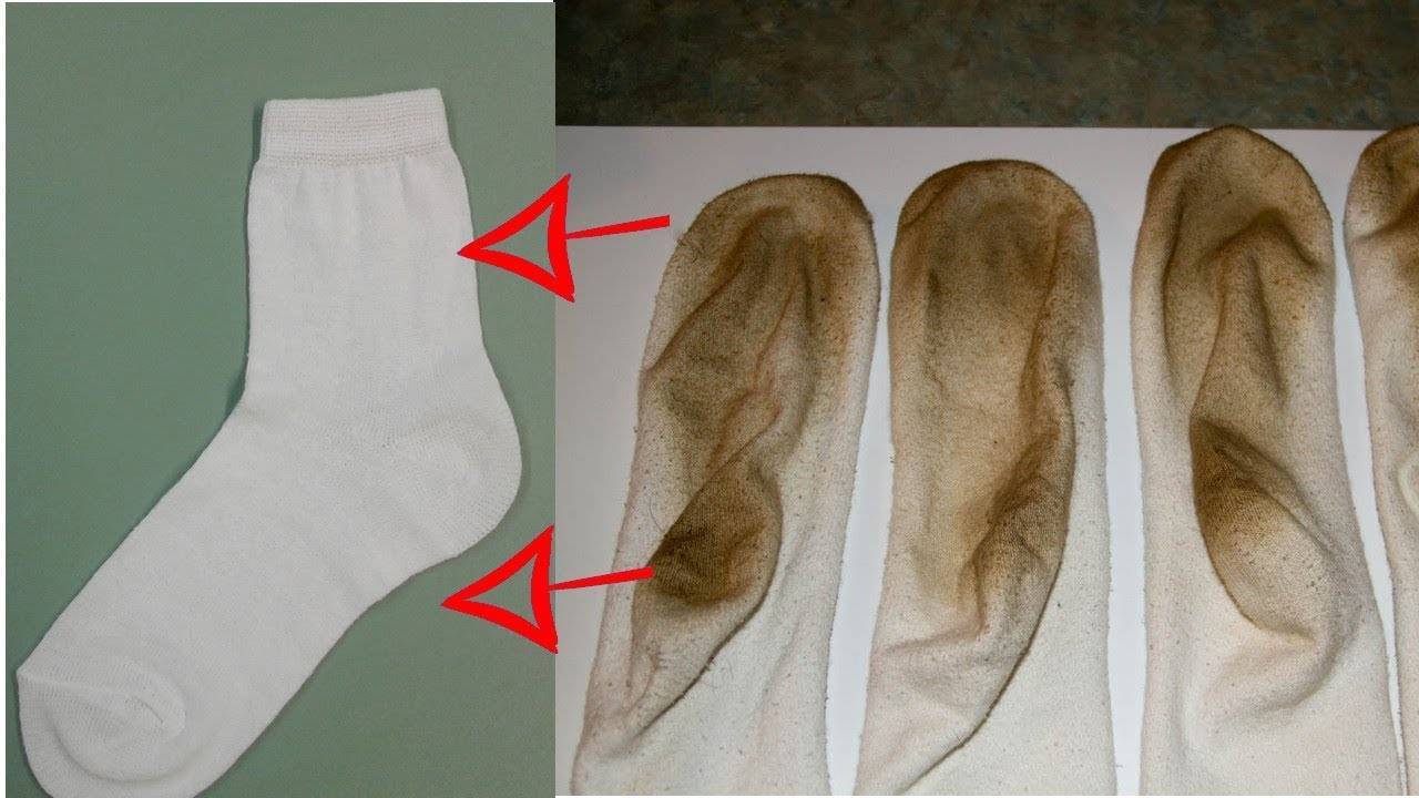 Как отстирать белые носки — домашние советы