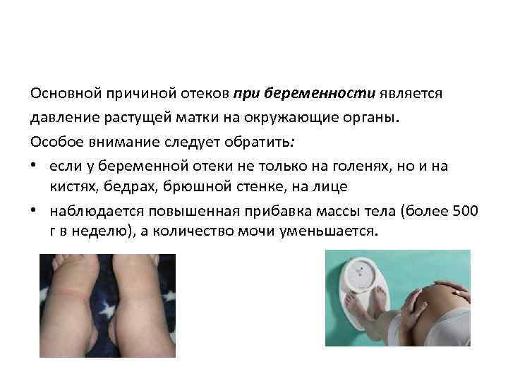 Отек носа при беременности ‒ чем лечить?