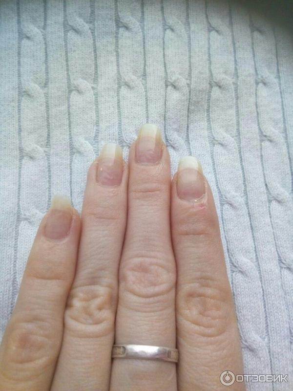 Как быстро отрастить ногти