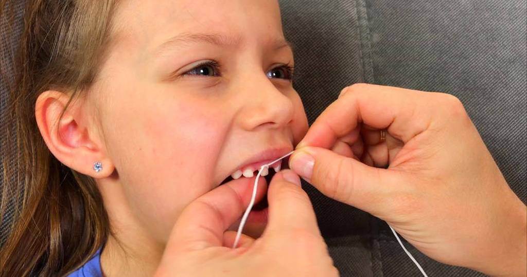 Куда деть выпавшие молочные зубы | детская стоматология shifa