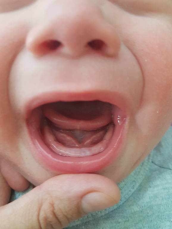 Симптомы того, что у ребенка режутся зубы?