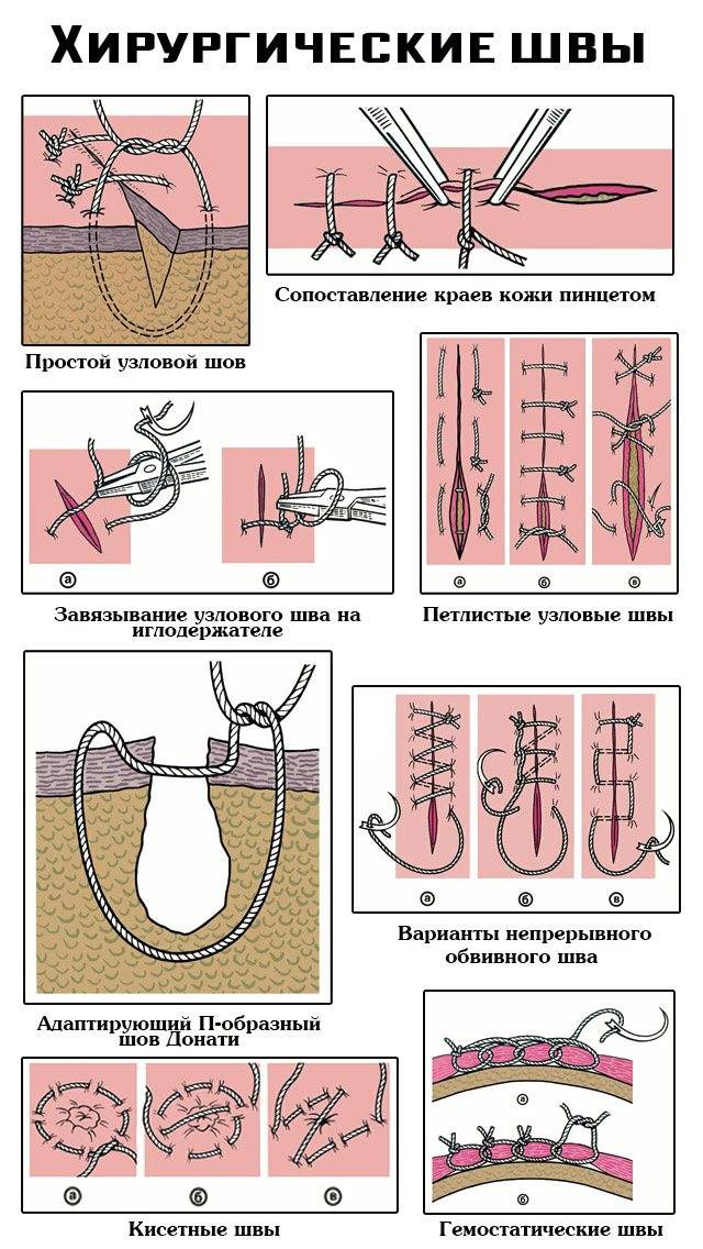 Какой шов изображен на рисунке