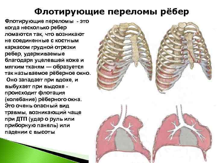 Карта вызова ушиб ребер слева