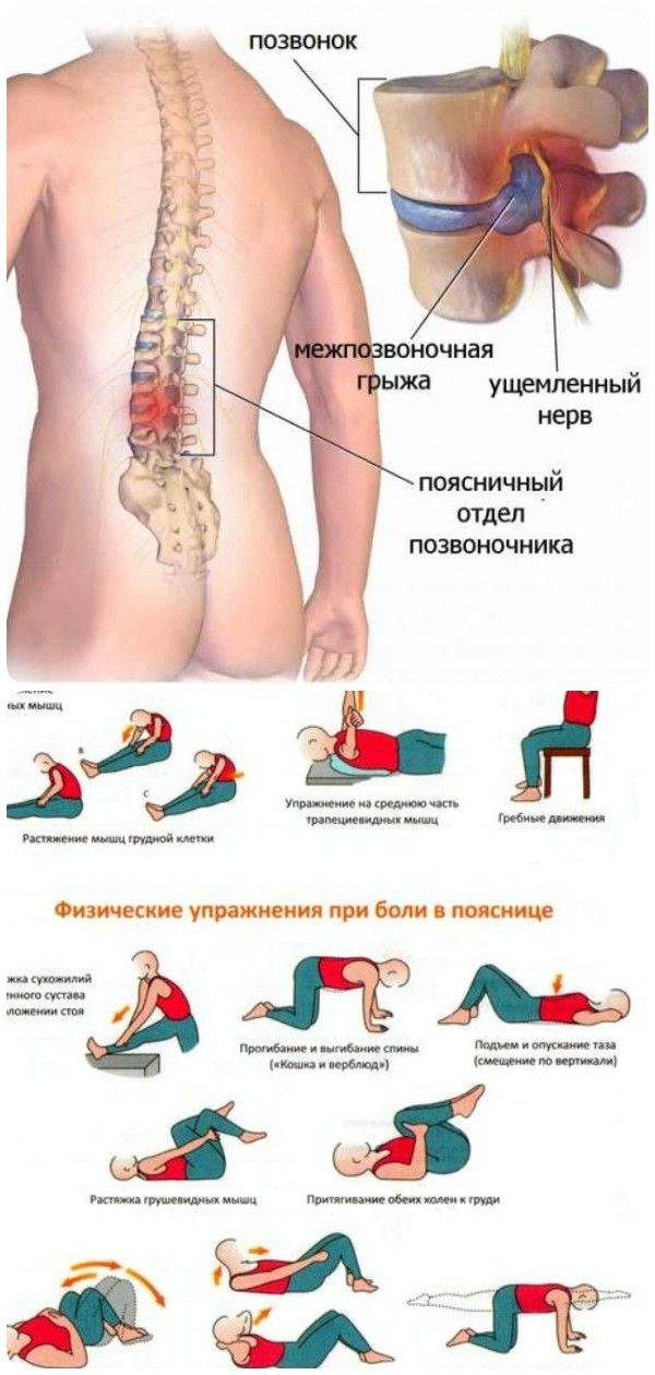 Схема лечения при грыже позвоночника поясничного отдела