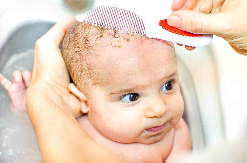 Себорейный дерматит у детей: что делать с «молочными корочками» на голове? - euroderm