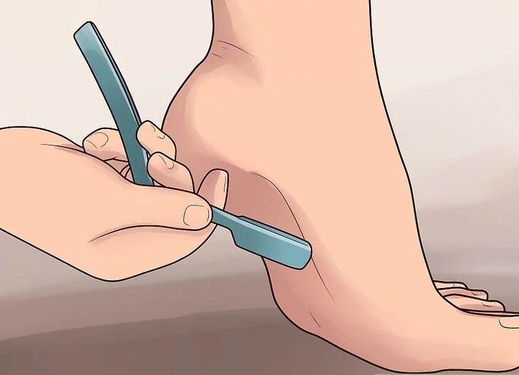 Как вытащить занозу из пальца или стопы - эффективные способы