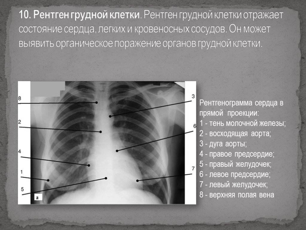 Прицельные рентгеновские снимки (targeted x-rays*)