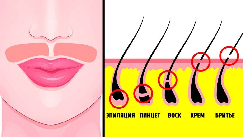 Способы удаления волос на лице и теле