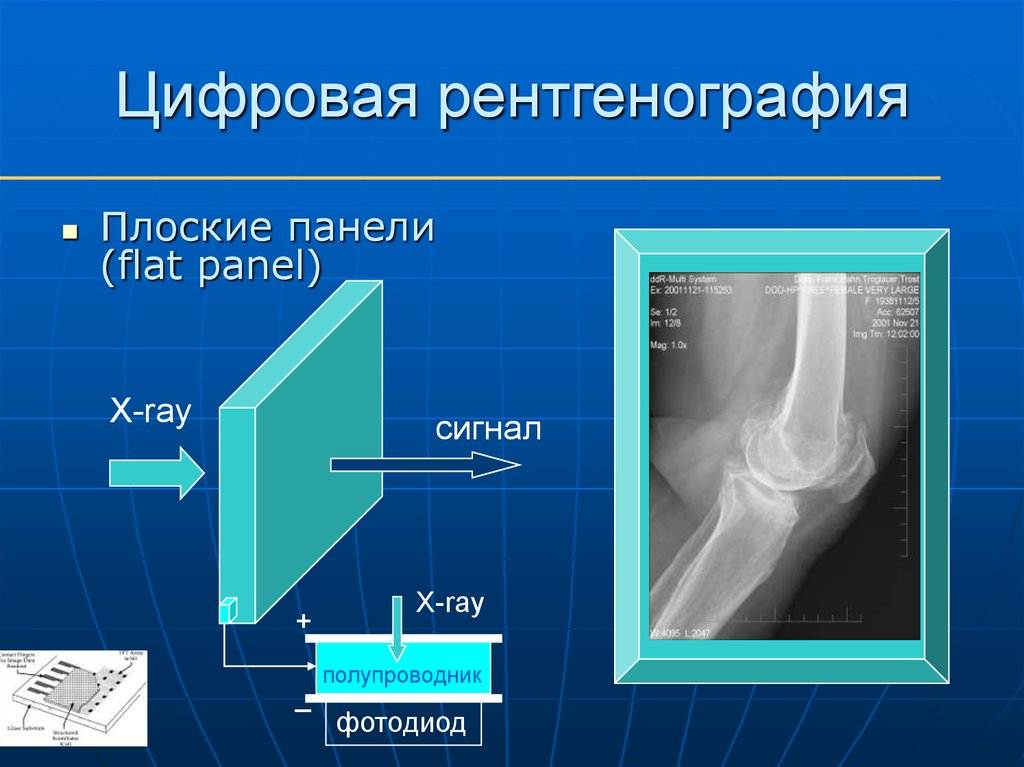 Изображение получаемое на рентгеновской пленке