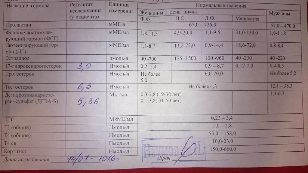 Какие анализы на гормоны при андрогенной алопеции