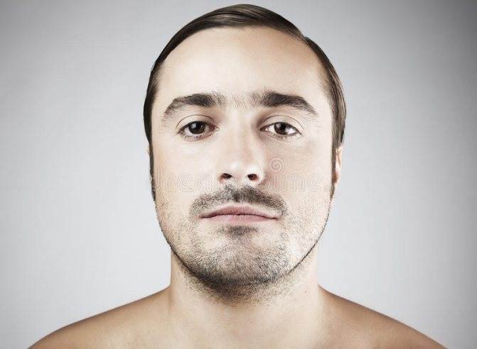 Каковы основные причины неравномерного роста бороды