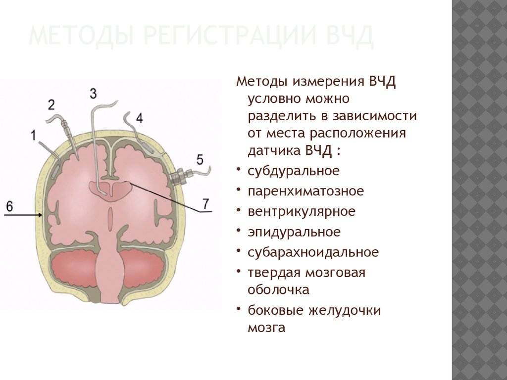 Внутричерепное давление. Неинвазивные методы измерения ВЧД. Инвазивный метод измерения внутричерепного давления. Методы измерения ВЧД. Способ измерить внутричерепное давление.