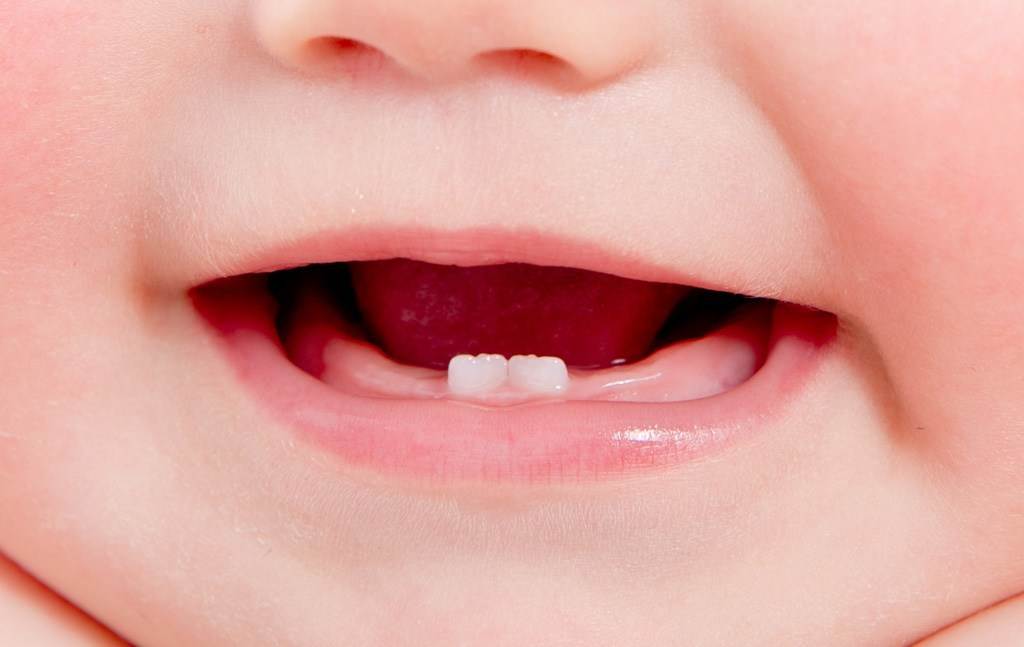 Симптомы прорезывания зубов у малышей - признаки режущихся зубов у ребенка