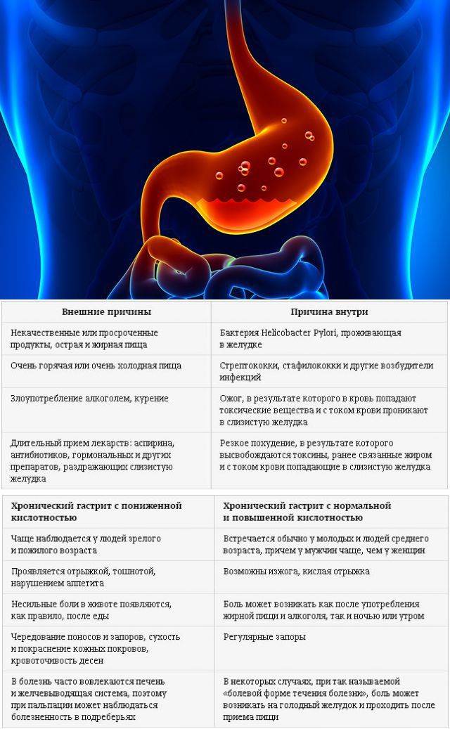 Как защитить желудок от нпвп — советы эксперта