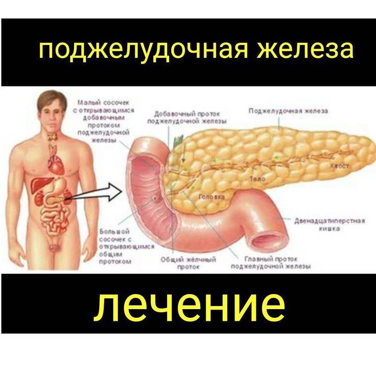 Панкреатит поджелудочной железы