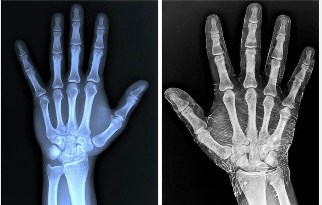 Пациентам: кт, мрт, узи, рентген. что проверяют сканированиями?