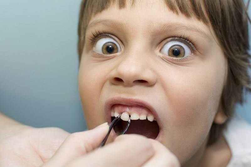 Как удалить молочный зуб ребенку в домашних условиях. шатающиеся зубы у детей