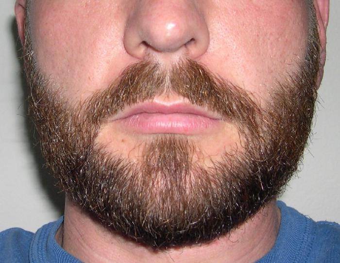 Почему не растет борода в 17, 19, 25, 30 и 40 лет: основные причины
