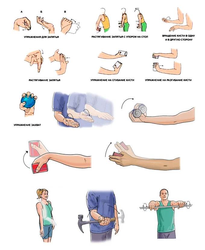 Лечение артроза плечевого сустава - нолтрекс.