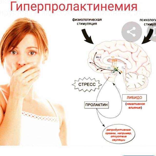 Повышение пролактина. Гиперпролактинемия. Повышенная секреция пролактина. Гиперпролактинемия у женщин. Повышение уровня гормона пролактина.