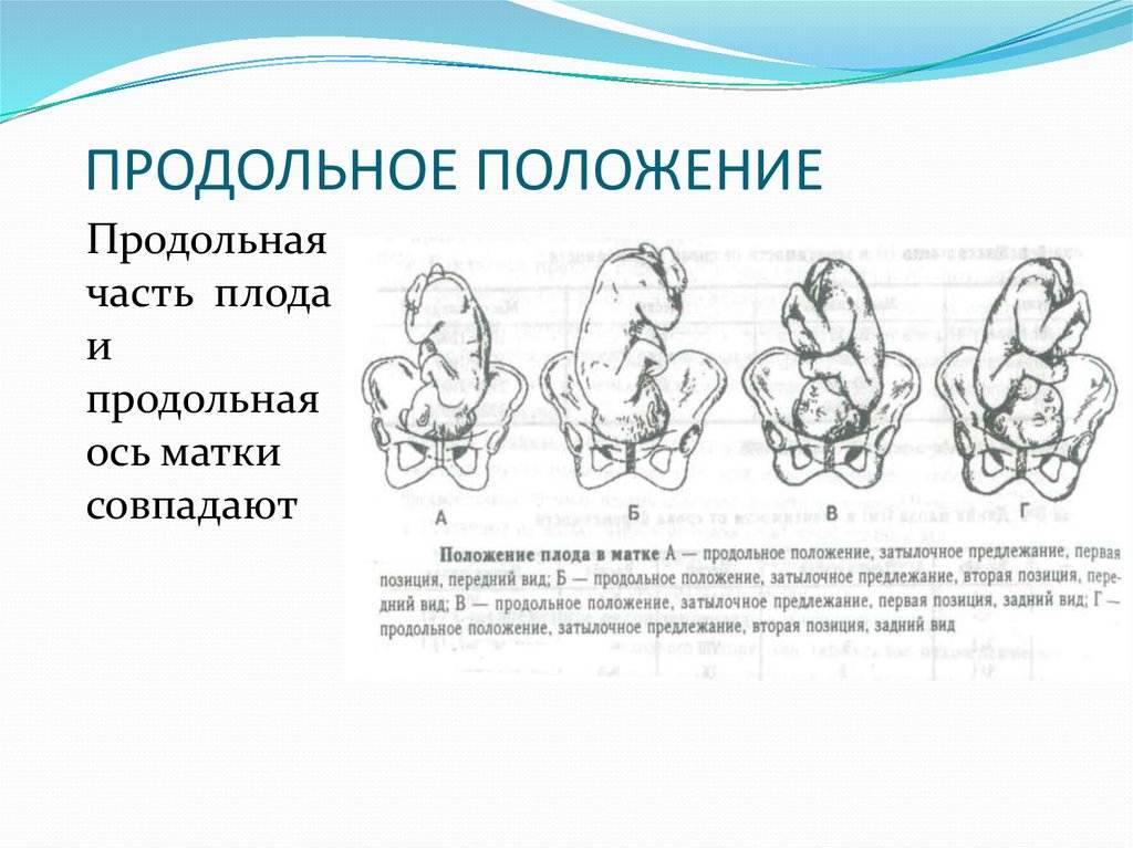 Как определить положение ребенка в животе самостоятельно