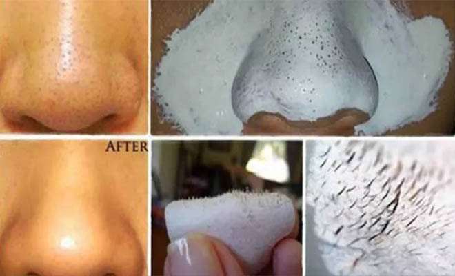 Какая чистка лица лучше для вашей кожи