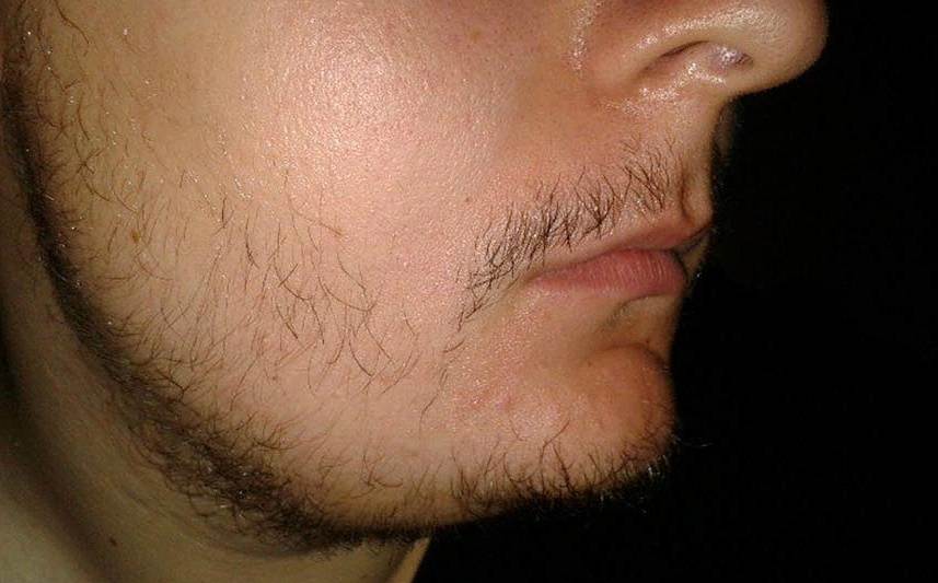 Как отрастить красивую бороду в 14-17 лет