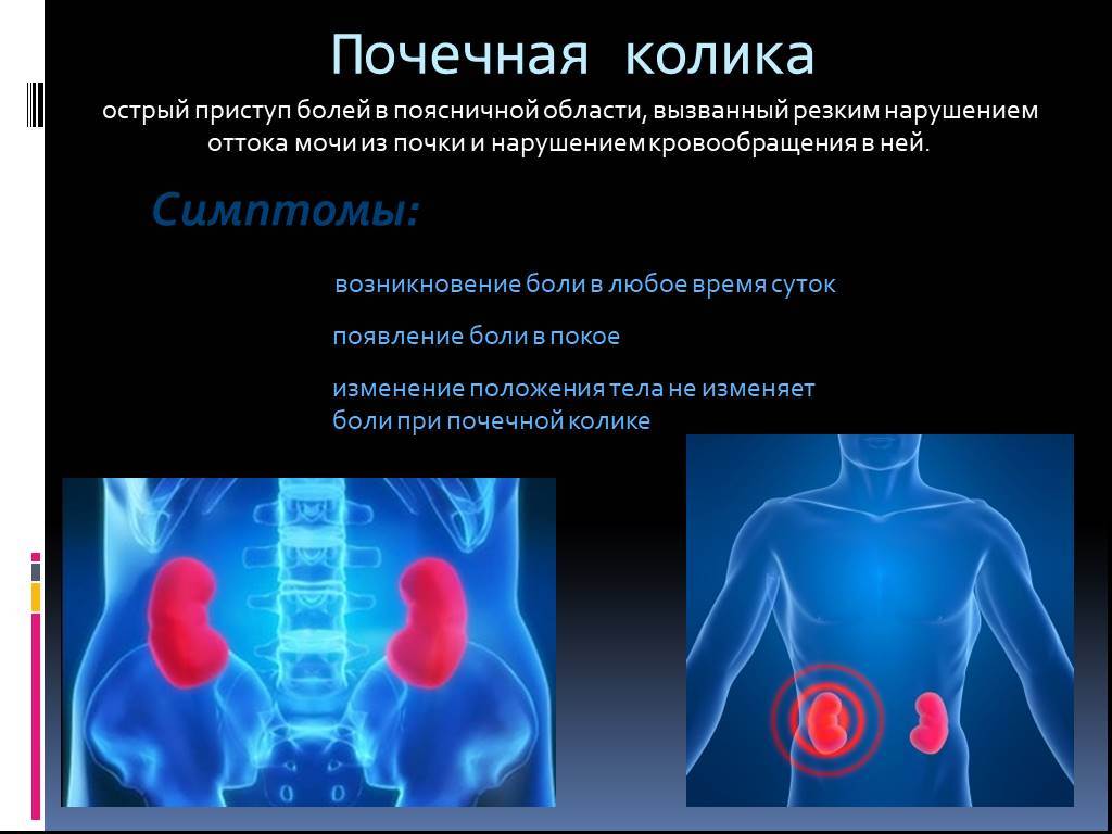 Где находится почки у человека фото и как болит какие симптомы