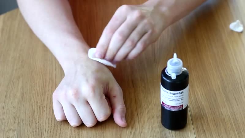 Чем отмыть йод с кожи: простые и эффективные способы, видео