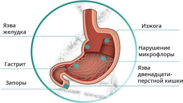 Как восстановить защитные свойства желудка при рефлюксной болезни