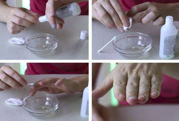 Чем отмыть марганцовку с кожи рук и некоторых поверхностей