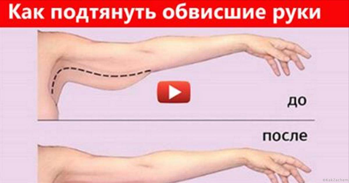 Упражнения против дряблой, обвисшей кожи рук