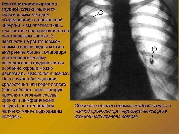 Алгоритм внутриротового лучевого исследования и описания снимков зубов - dentalmagazine.ru