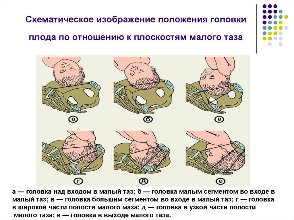 Когда ребенок переворачивается вниз головой в животе во время беременности - журнал expertology