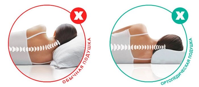 Обзор ортопедических подушек: как обеспечить высокое качество сна