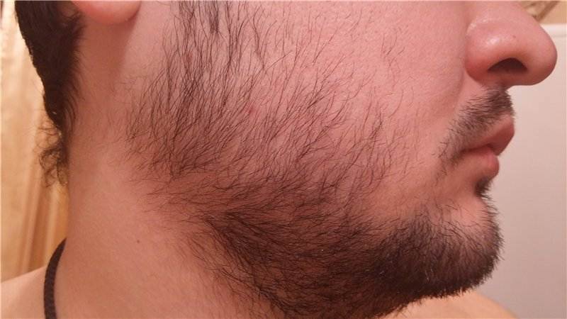 Рост волос на шее у мужчин